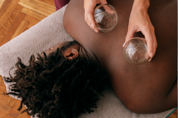 cupping therapy in Lexington, KY